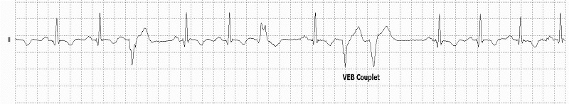 VEB Couplets Rhythm Strip